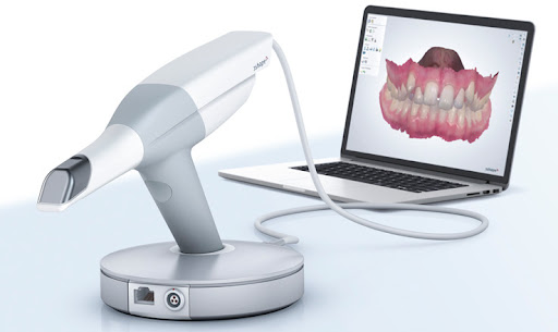 O que é o scanner intraoral?