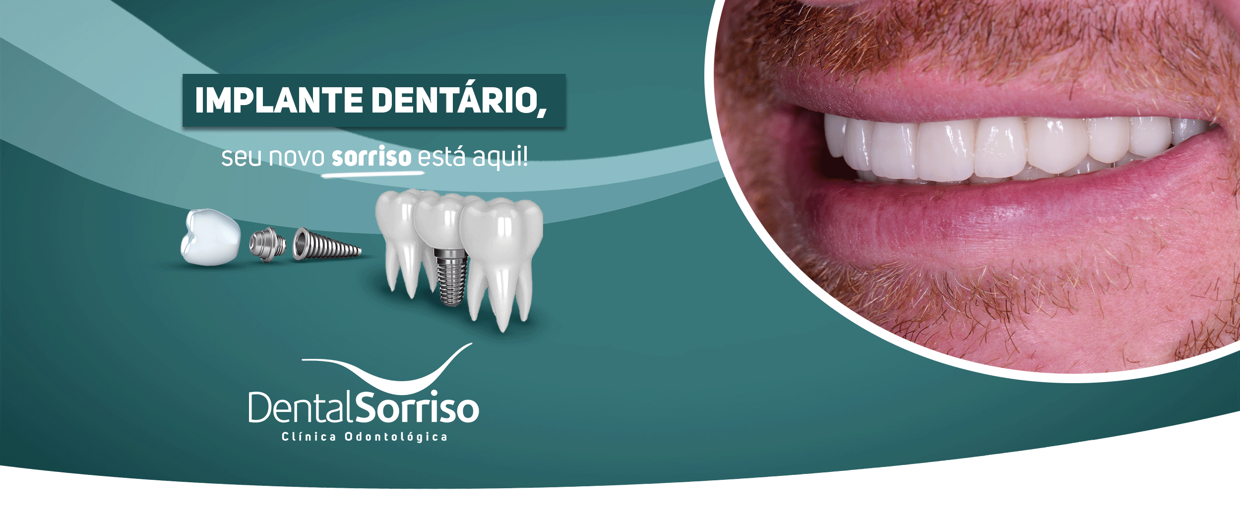 2 CapaSite 2500x1045px Dental