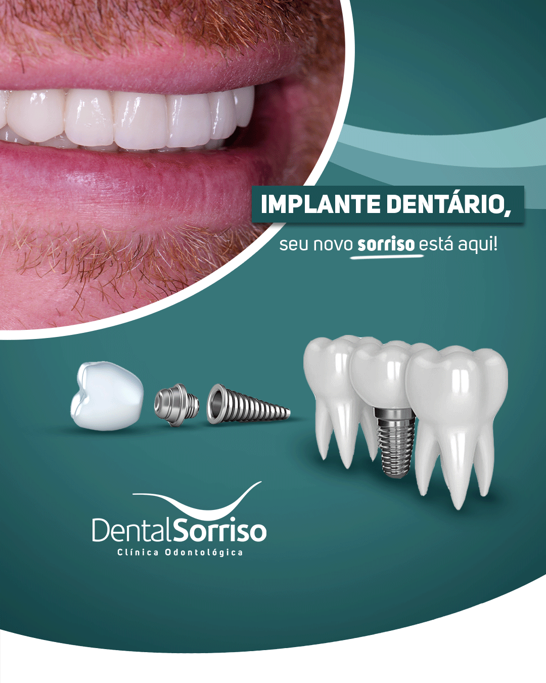 1 CapaSite 2500x1045px Dental Mobile