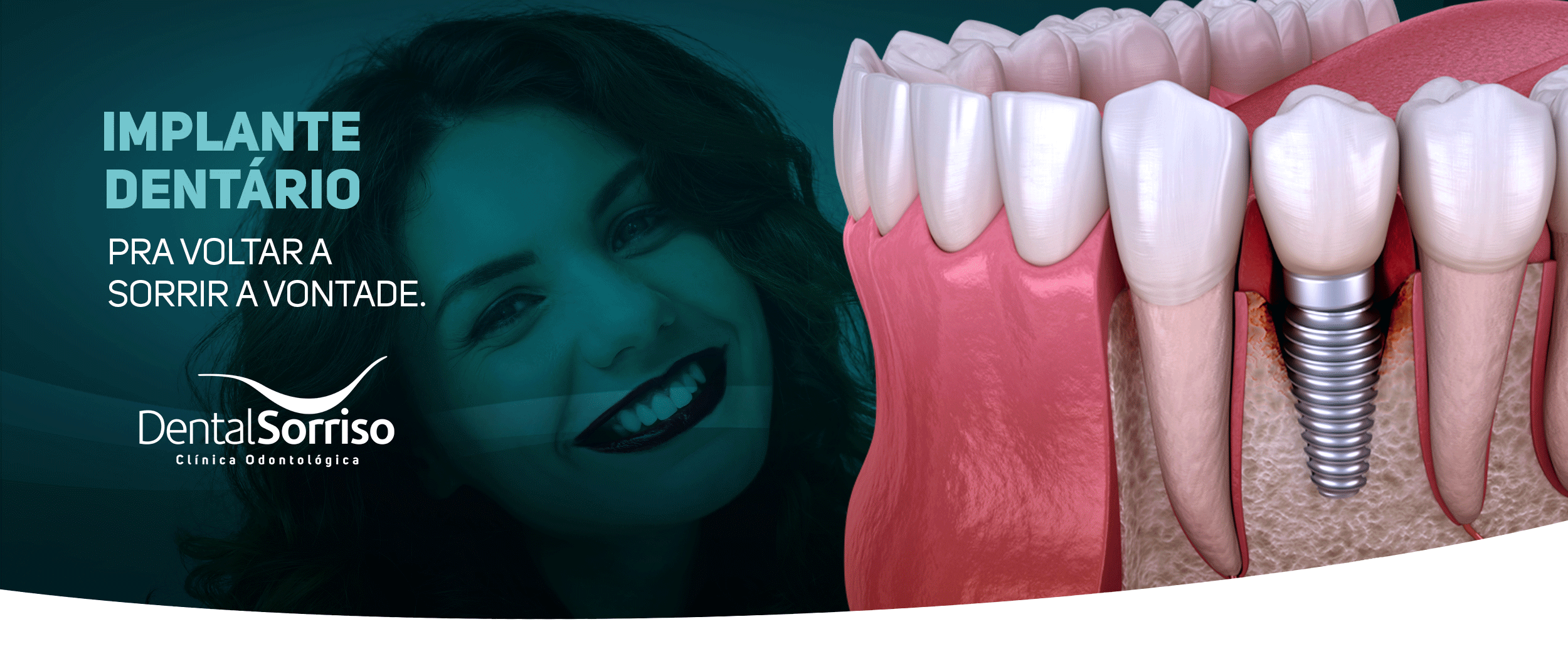 1 CapaSite 2500x1045px Dental